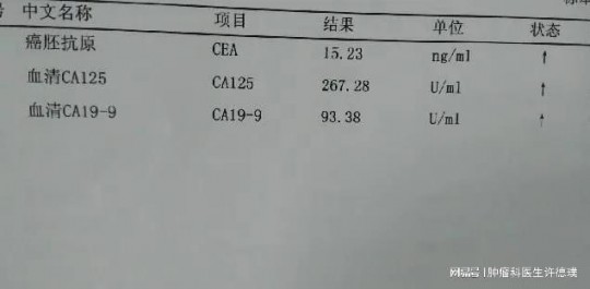 癌胚抗原定性,癌胚抗原定性是什么意思