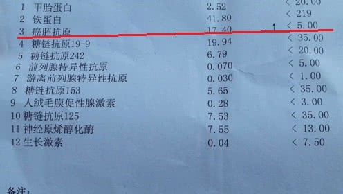 癌胚抗原定性,癌胚抗原定性是什么意思