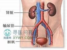 尿路感染流脓,尿路感染流脓怎么办