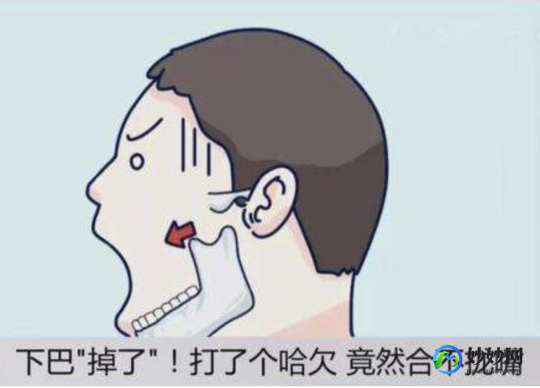 下巴脱臼,打哈欠下巴脱臼