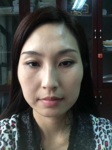 改脸,脸型可以后天改变吗