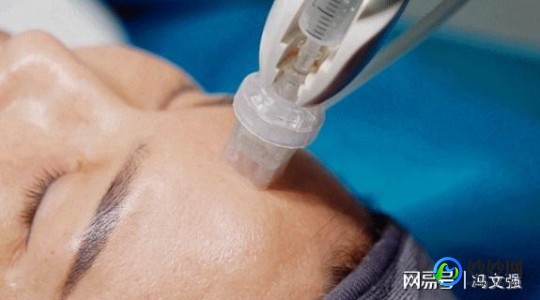 做光子嫩肤好不好,光子嫩肤效果好吗