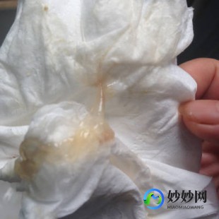 一用力下面流了透明液体,剧烈运动时下面有液体流不疼不痒