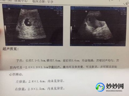 5周有胎心胎芽吗,怀孕5周有胎心胎芽吗