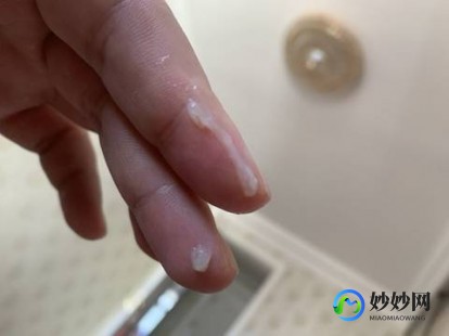 有白带是怀孕了吗,来白色液体是不是要怀孕