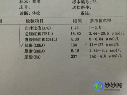 肌酐48正常吗,血肌酐正常值是多少