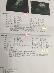 97mm,双顶径97mm头算大吗