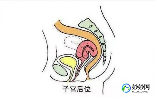 子宫后位,子宫后位是什么意思
