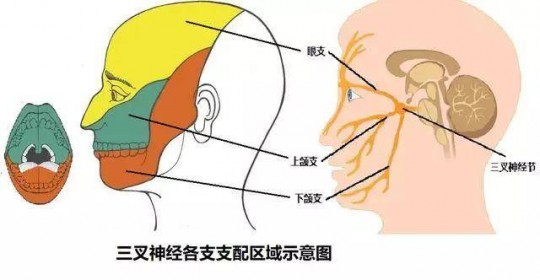 三叉神经手术费多少钱,三叉神经痛手术费用是多少