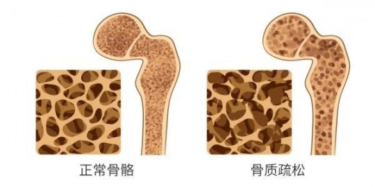 来月经能吃钙片吗,月经期间能不能吃钙片