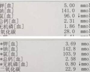 二氧化碳结合力,二氧化碳结合力偏高是什么意思