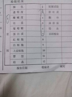 尿检,体检尿检是检查什么