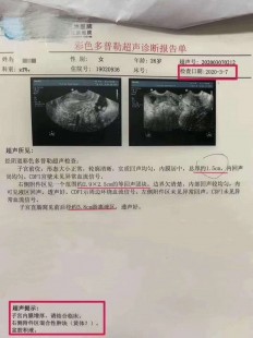 盆腔积液会自愈吗,盆腔积液35mm能自愈吗