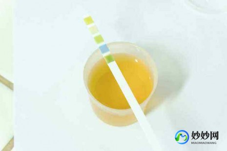 为什么尿很黄,为什么尿液是黄色的