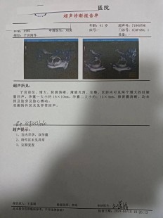 怀孕b超怎么看,早孕b超单怎么看