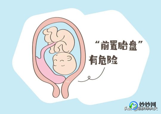 低置胎盘,胎盘呈低置状态怎么办