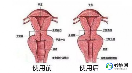 什么样的女人阴紧,阴紧是什么原因