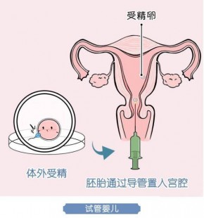 试管取精新突破 精子数量少也能成功受孕
