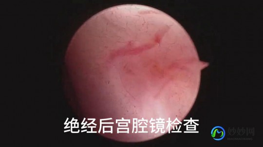 宫颈萎缩,宫颈萎缩是怎么回事
