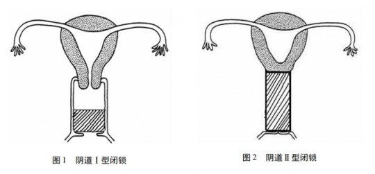 12岁的少女月经过程,例假的行成过程是什么