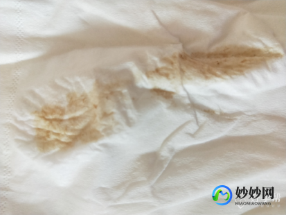 分泌物发黄,分泌物是黄颜色怎么回事