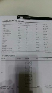 尿酸多少,尿酸正常值最新标准