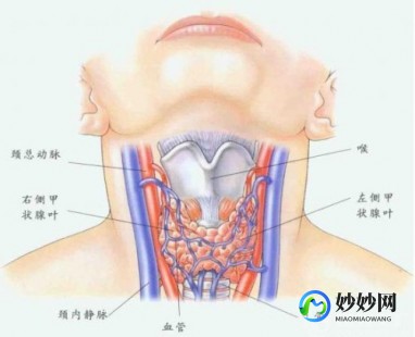 甲状腺结节四级,甲状腺结节4级是什么意思