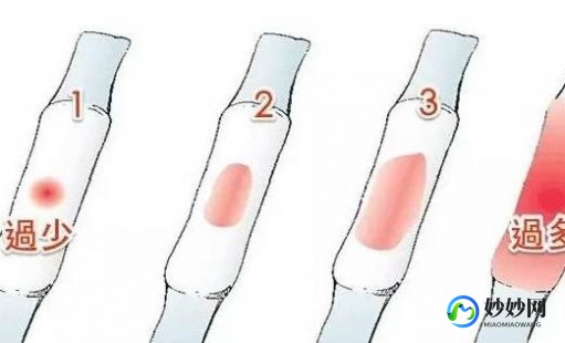 大姨妈量多,月经特别多是什么原因