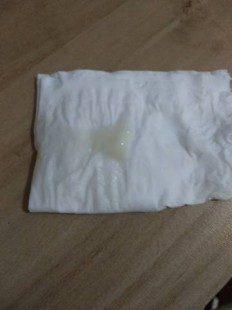 什么样的白带是怀孕了,白带像蛋清是怀孕了吗