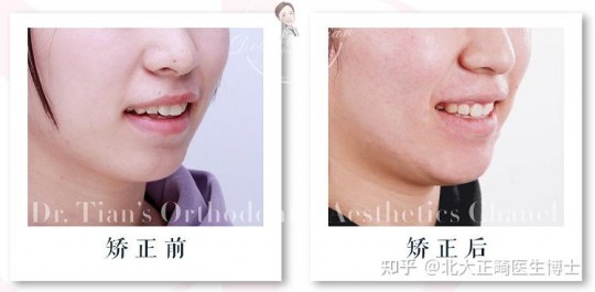 大小脸挂什么科,大小脸矫正挂什么科