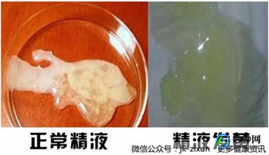 精子正常颜色,男性精子是什么颜色正常