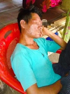 低烧的原因,一直低烧什么原因