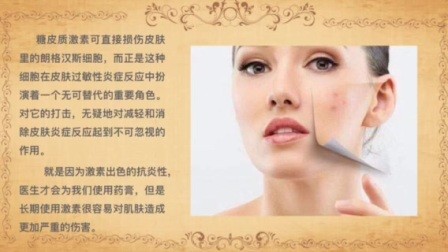 美肤康灵,美肤康灵治疗皮炎、湿疹效果怎么样？