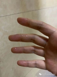 白带拉丝,白带透明拉丝