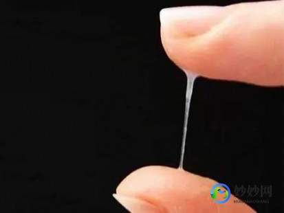 有白带是怎么回事,女性老是流白色的东西