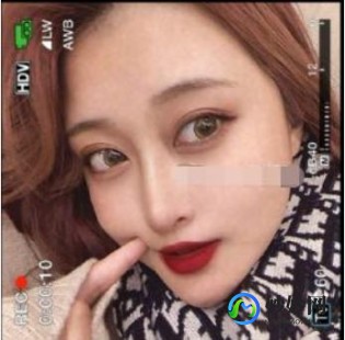 心肌梗塞猝死,心梗猝死是什么原因造成的