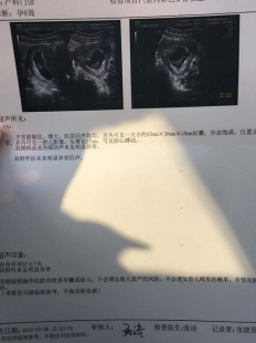 怀孕六个月,怀孕六个月是多少周多少天