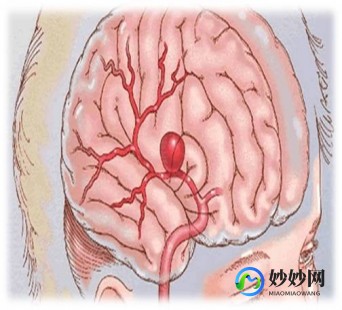 怎么区分痔疮出血和肠道出血,怎么判断痔疮出血和肠道出血