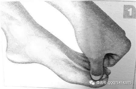 什么是崩漏,崩漏的介绍