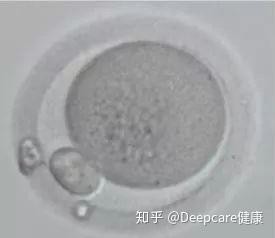 透明带,蜡状透明带能提高卵子质量的原理是什么？