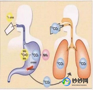 碳13,碳13呼气试验正常值