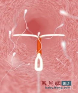 精子质量标准颜色,男人精子是什么颜色为正常