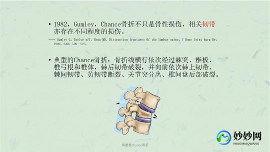 chance骨折,Chance骨折是什么意思