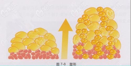 怎么去掉悬针纹,怎样去掉悬针纹