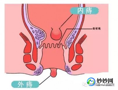 郑州肛肠医院,郑州肛肠医院-郑州痔疮医院排名-郑州看肛肠科哪家医院好