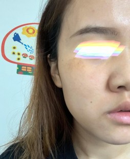 皮肤泛黄,皮肤越来越黄