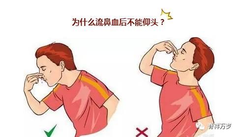 流鼻血的原因及治疗,流鼻血怎么治疗