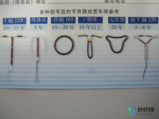绝育环,节育环的形状图片有几种