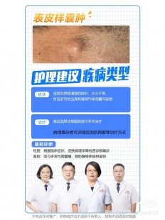 皮脂腺囊肿,皮脂腺囊肿长什么样