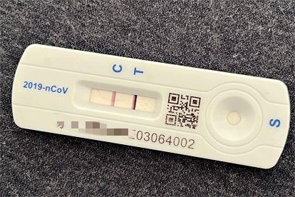 男子三阳抗原呈深紫色,抗原检测紫色正常吗